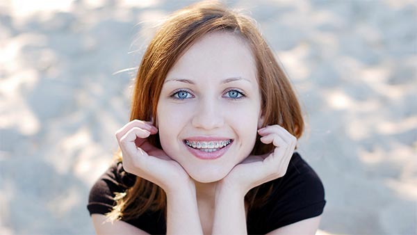 Clear Correct aligners for teeth correction, practiced by Mandeville Dentist Dr. Lisa Landesman