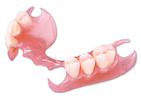 Image of partial dentures that clasp to teeth, General Dentistry Camellia Creek Dental Center